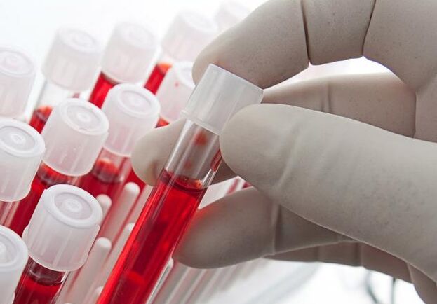 արյան ստուգում ալկոհոլ օգտագործելուց հետո